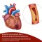 Beh Artery+ kapslid (90 tk)